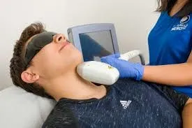 Depilación láser de alta precisión: cuando la piel entra en equilibrio